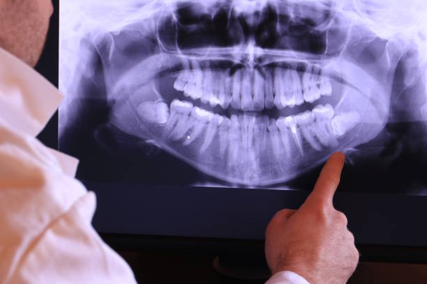 Best Emergency Dentist for Knocked-Out Tooth in Tower City, PA