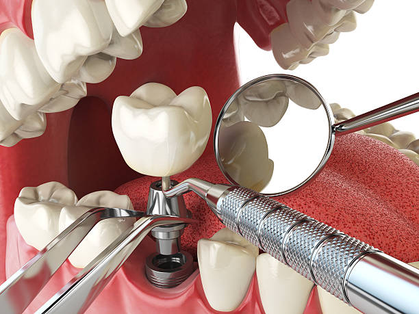 Best Emergency Dental Extractions in Tower City, PA